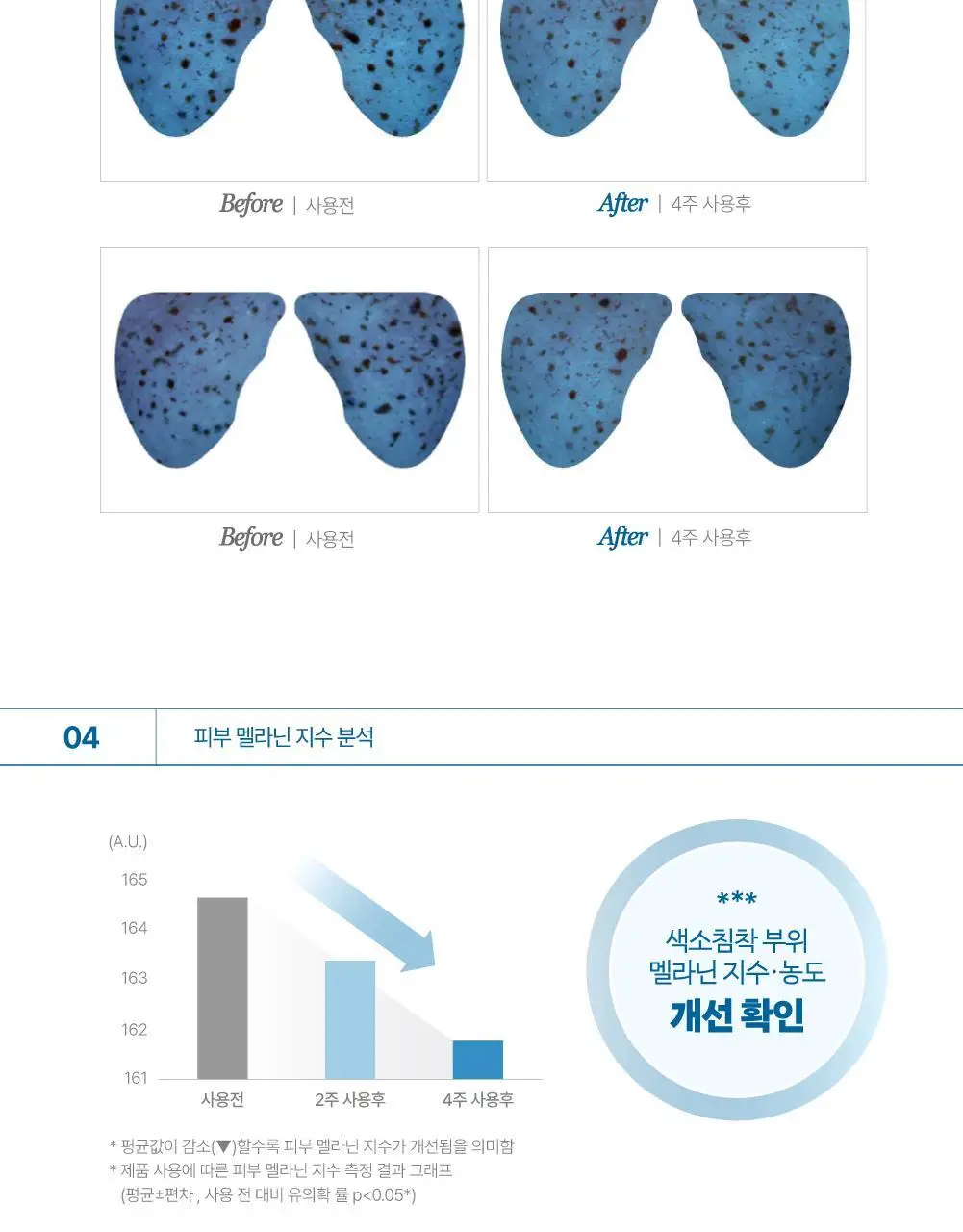 [리뷰이벤트] 라보타치 다크스팟 케어 패치 32매 상세페이지 33